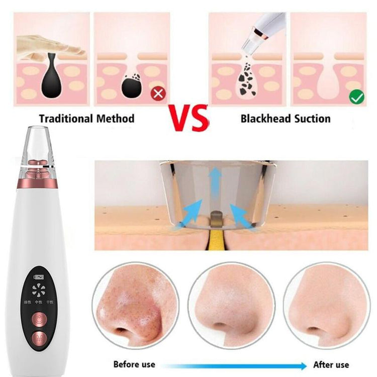 Blackhead Remover Face Pore Vacuum Skin Care Acne Pore Cleaner Tools